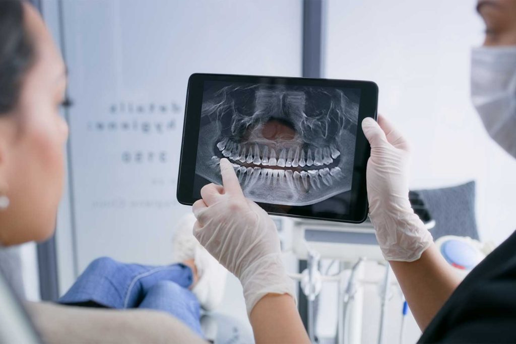 What Are Dental X-Rays? Answering Your Most Common Questions
