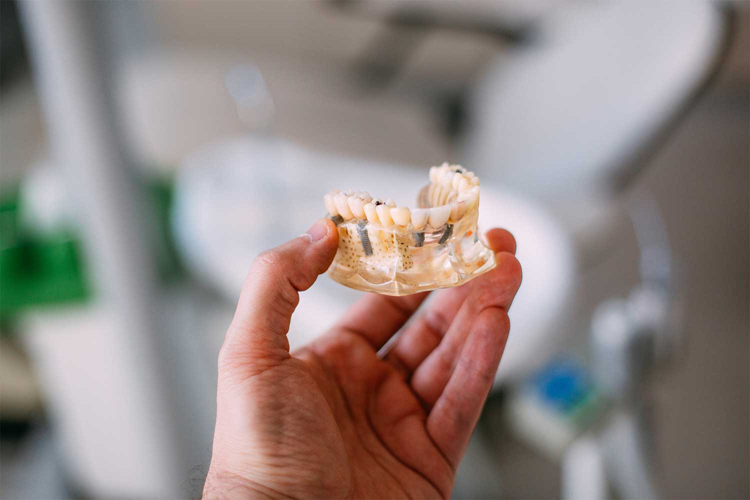 Dental Implants vs Dentures