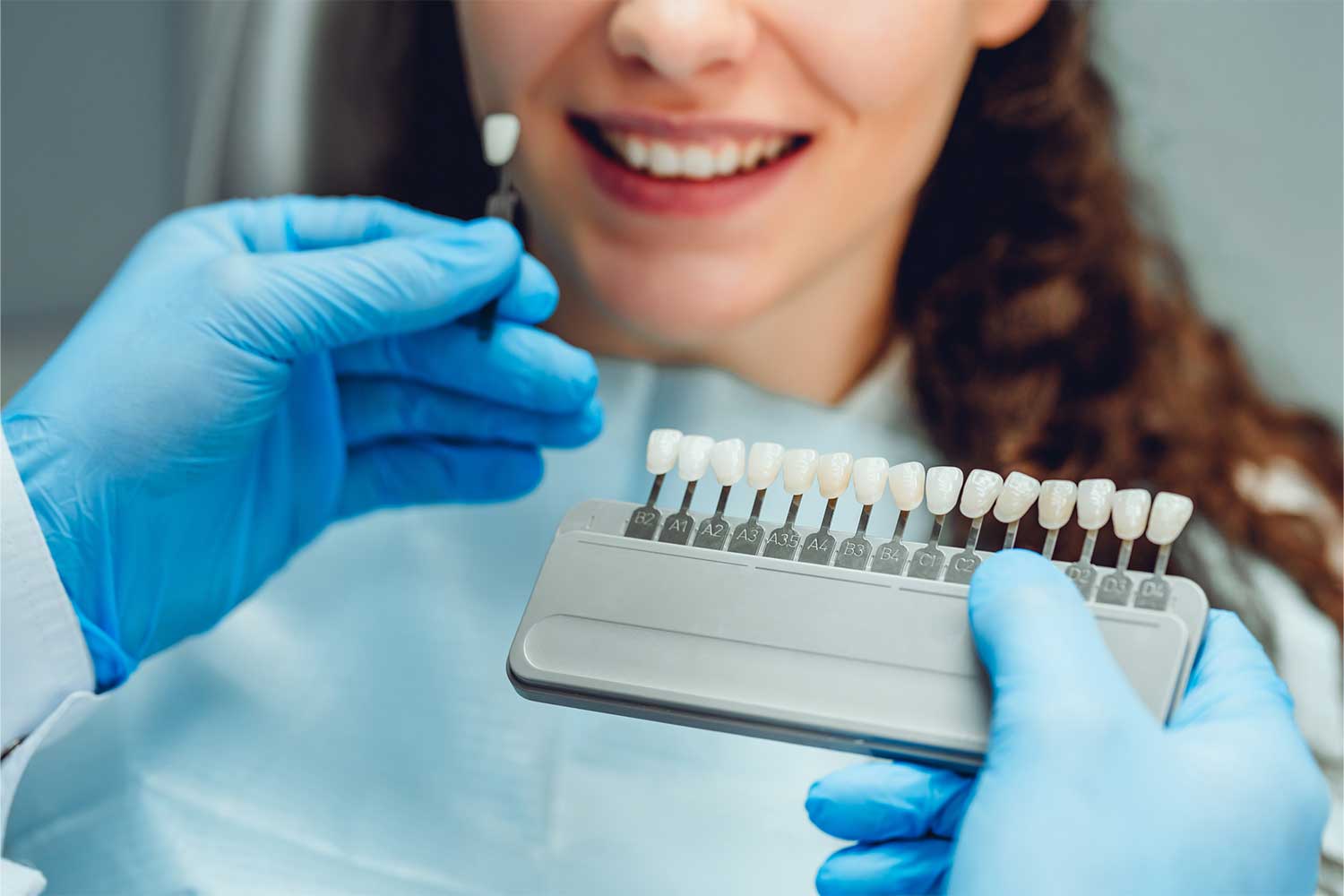Are Porcelain Veneers a Good Idea